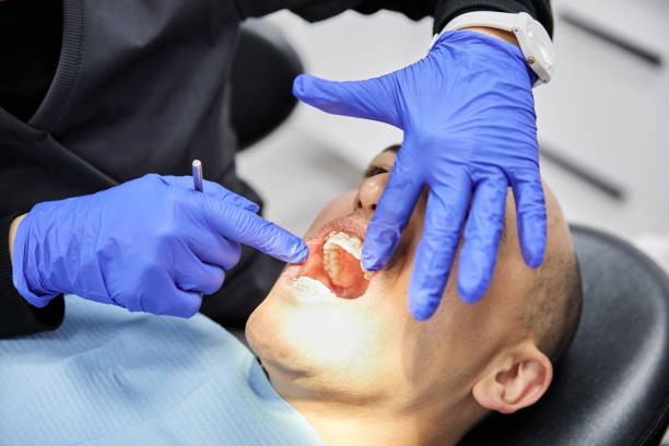 Best Emergency Treatment for Dental Infections or Abscesses in Rochester, IN